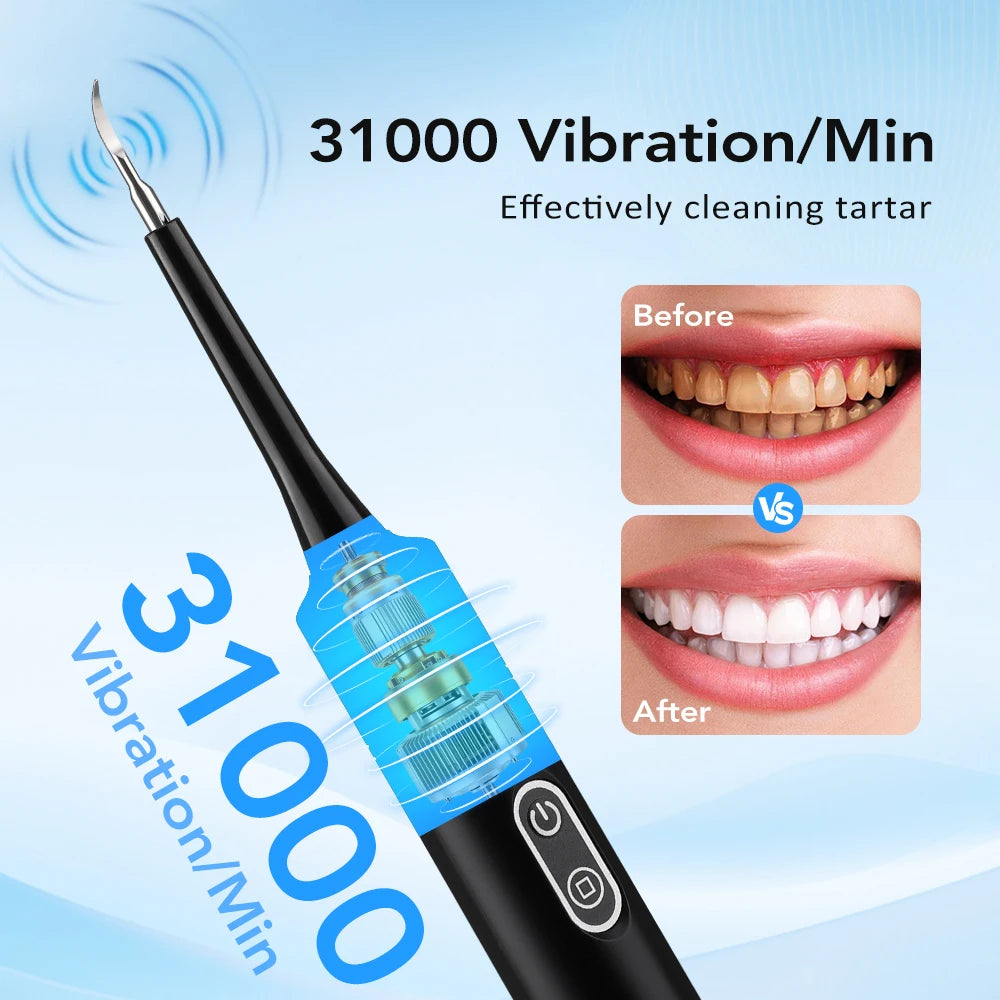 Electric Sonic Teeth Cleaner and Plaque Remover - 9