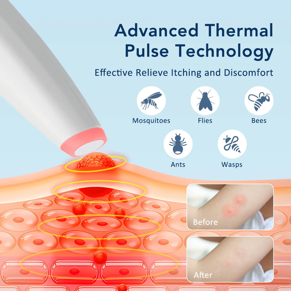 Electric Mosquito Bite Itch Relief Pen - 5