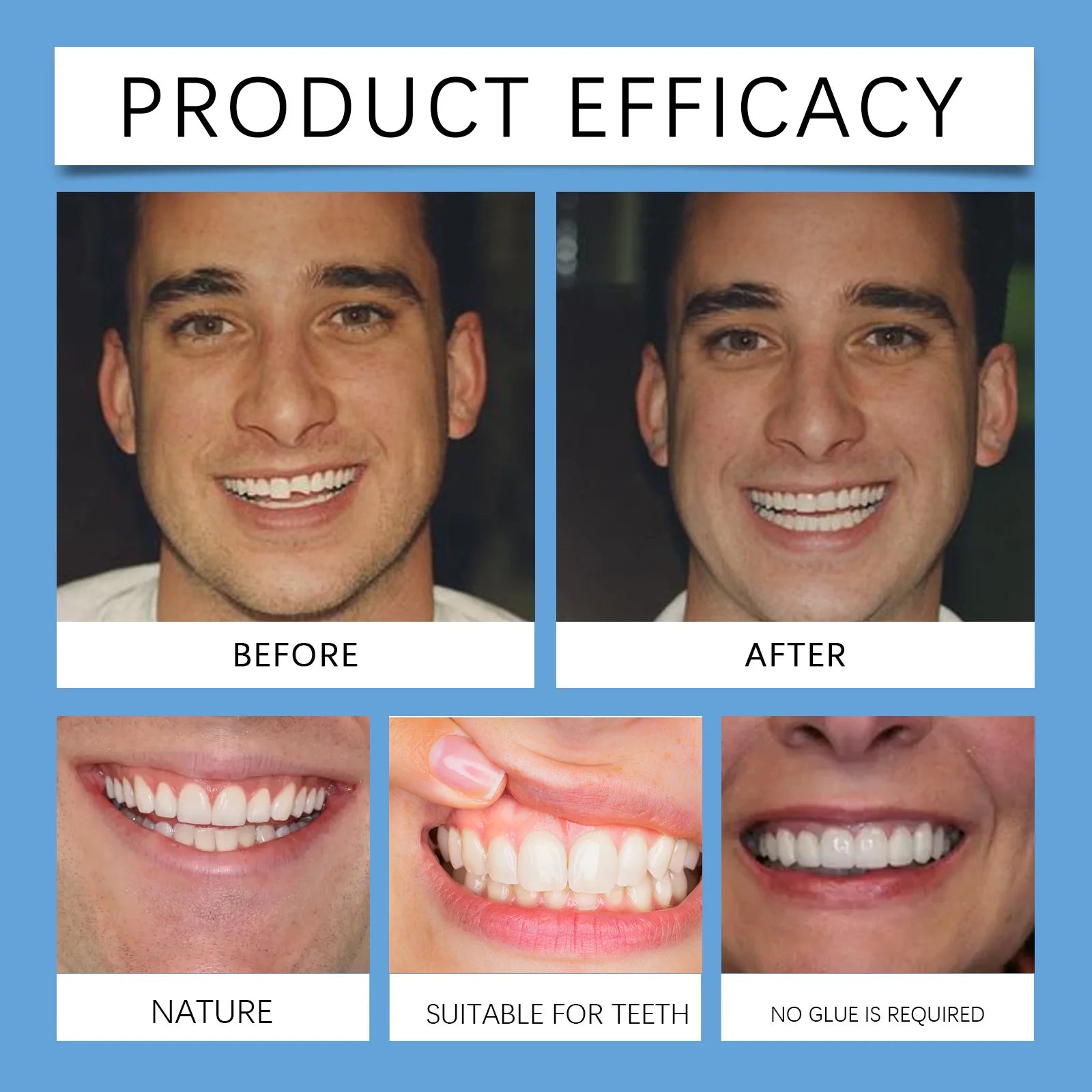 Adjustable Snap-On Smile Veneers for Missing Teeth - 18