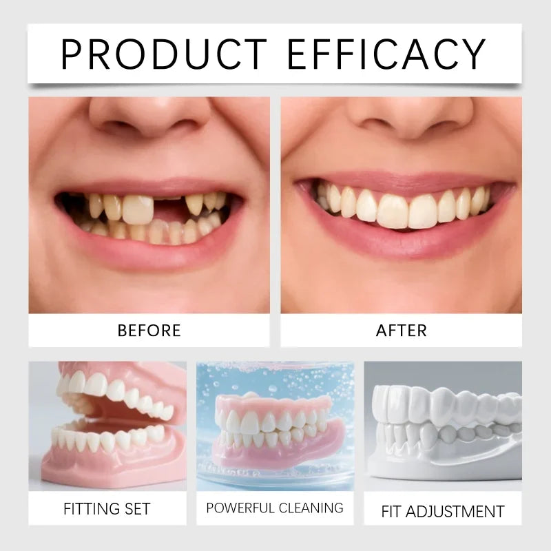 Temporary Silicone Cosmetic Dentures for Missing Teeth