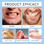 Temporary Silicone Snap-On Denture Set for Smile Whitening