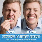 Comfort Fit Silicone Dentures for Instant Natural Smile