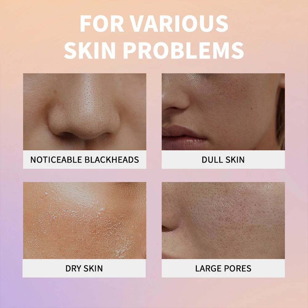 Exfoliating Rice Face Essence for Pore Cleansing and Brightening
