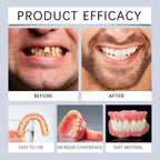 Flexible Silicone Denture Reline and Temporary Repair Kit