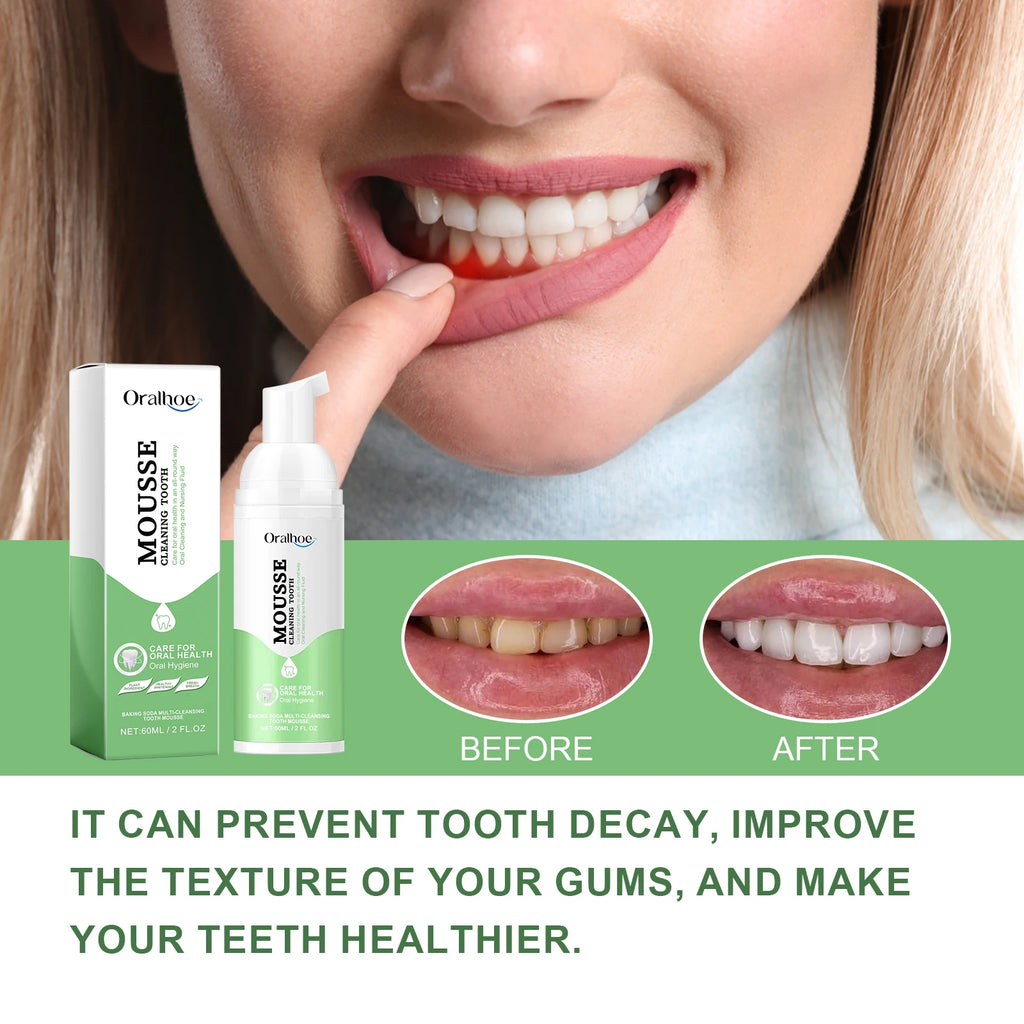 Whitening Foaming Toothpaste for Stain Removal