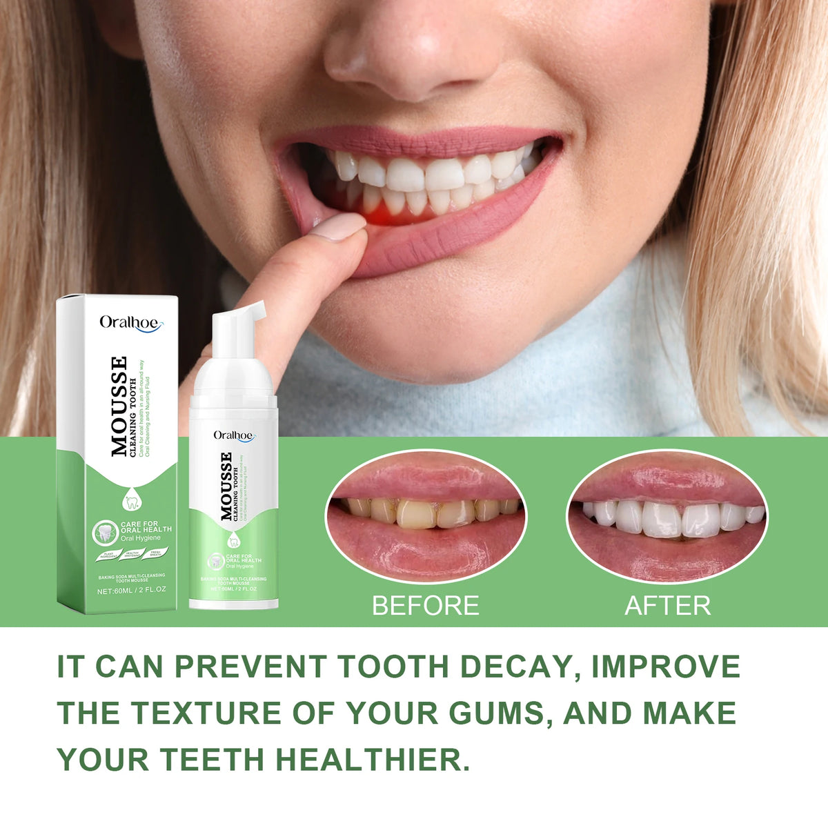 Whitening Foaming Toothpaste for Stain Removal