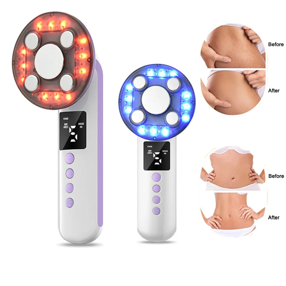3-in-1 Ultrasonic Body Slimming and Skin Tightening Massager - 1