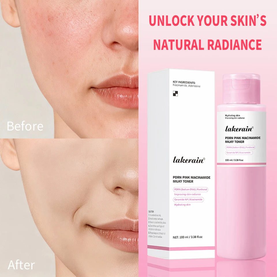 PDRN Niacinamide Milky Facial Toner for Hydrating Glowing Skin - 10