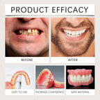 Temporary Silicone Denture Set for Instant Smile Restoration