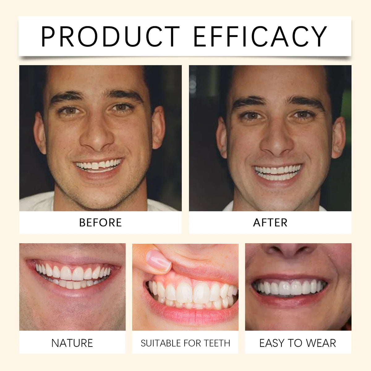Temporary Silicone Cosmetic Dentures for Smile Improvement
