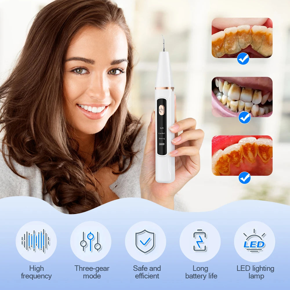 Ultrasonic Electric Teeth Tartar and Plaque Remover - 2