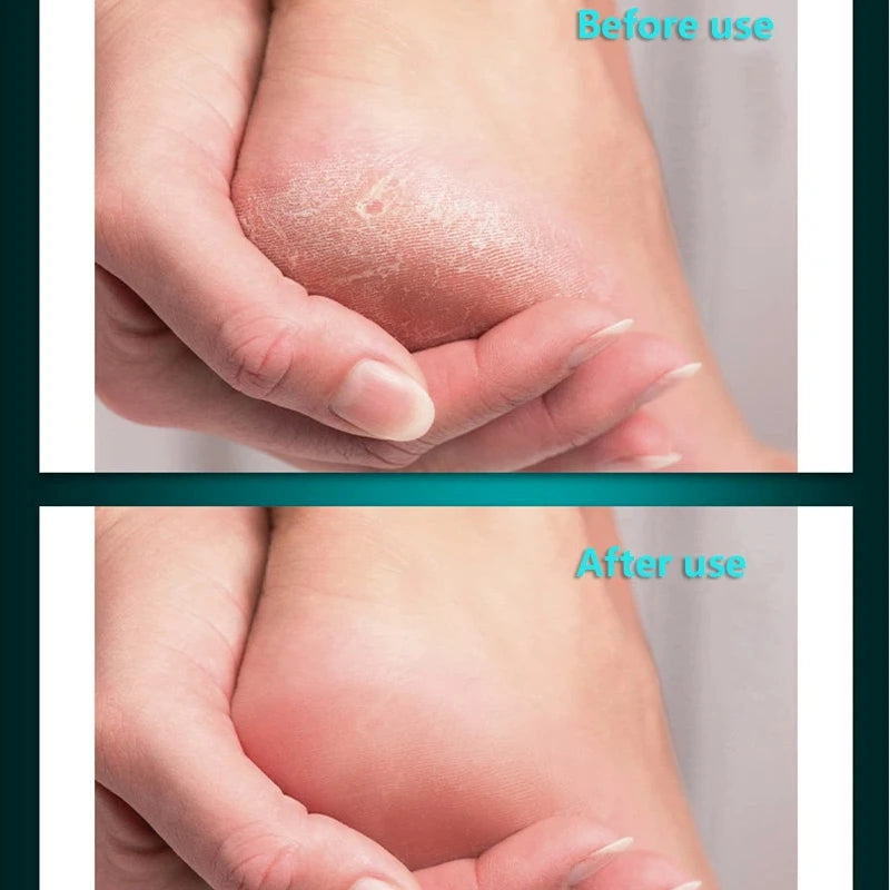 Professional Stainless Steel Foot File for Cracked Heels and Calluses