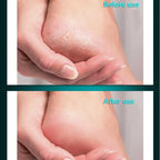 Professional Stainless Steel Foot File for Cracked Heels and Calluses