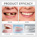 Temporary Silicone Dentures for Instant Smile Correction