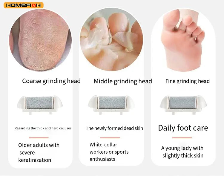 Electric Rechargeable Foot Callus Remover with Power Display