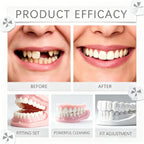 Instant Snap-On Silicone Smile Veneers for Natural Looking Teeth