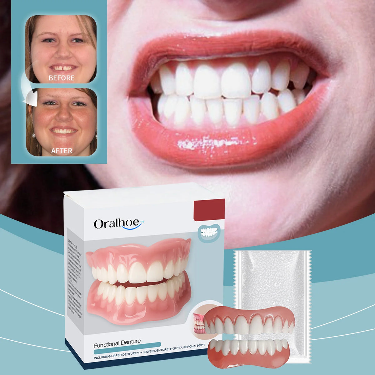 Temporary Silicone Denture Kit for Smile Restoration
