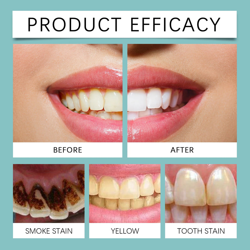 Instant Teeth Whitening Paint