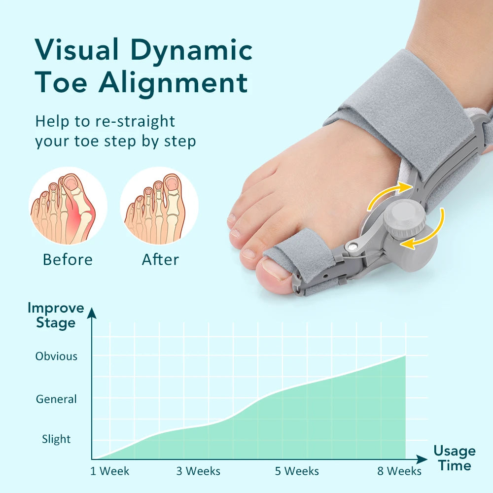 Adjustable Bunion Corrector and Toe Straightener