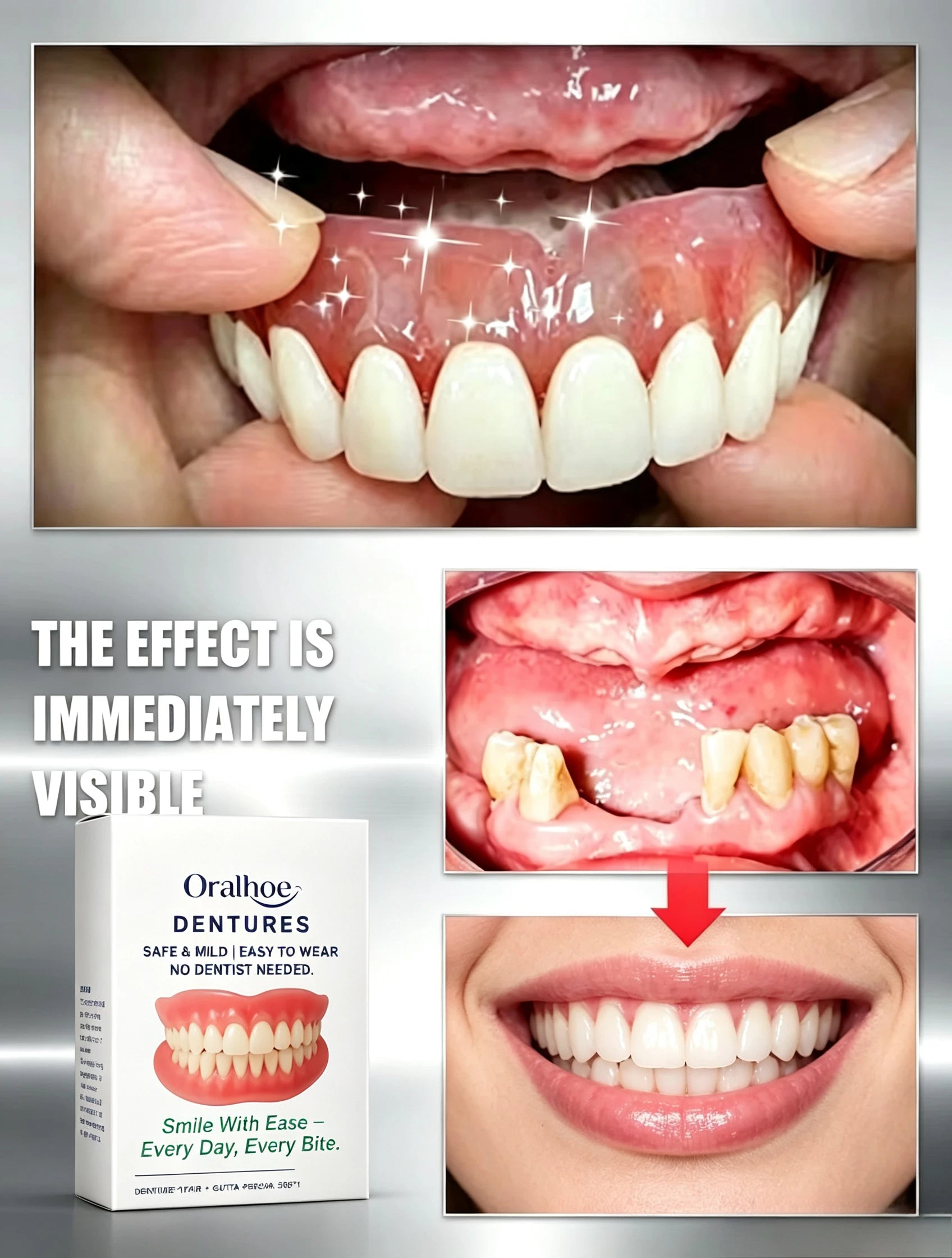 Adjustable Cosmetic Dentures for Instant Smile Restoration - 4
