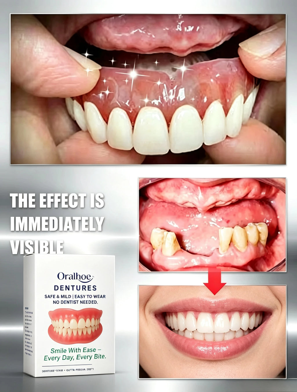 Adjustable Cosmetic Dentures for Instant Smile Restoration