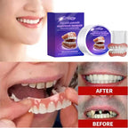 Flexible Silicone Denture Set for Instant Natural Smile
