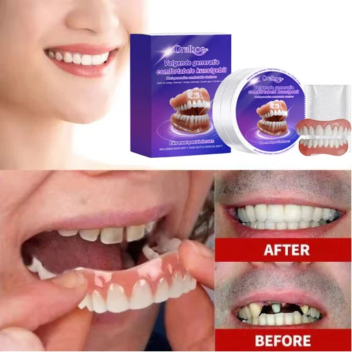 Flexible Silicone Denture Set for Instant Natural Smile