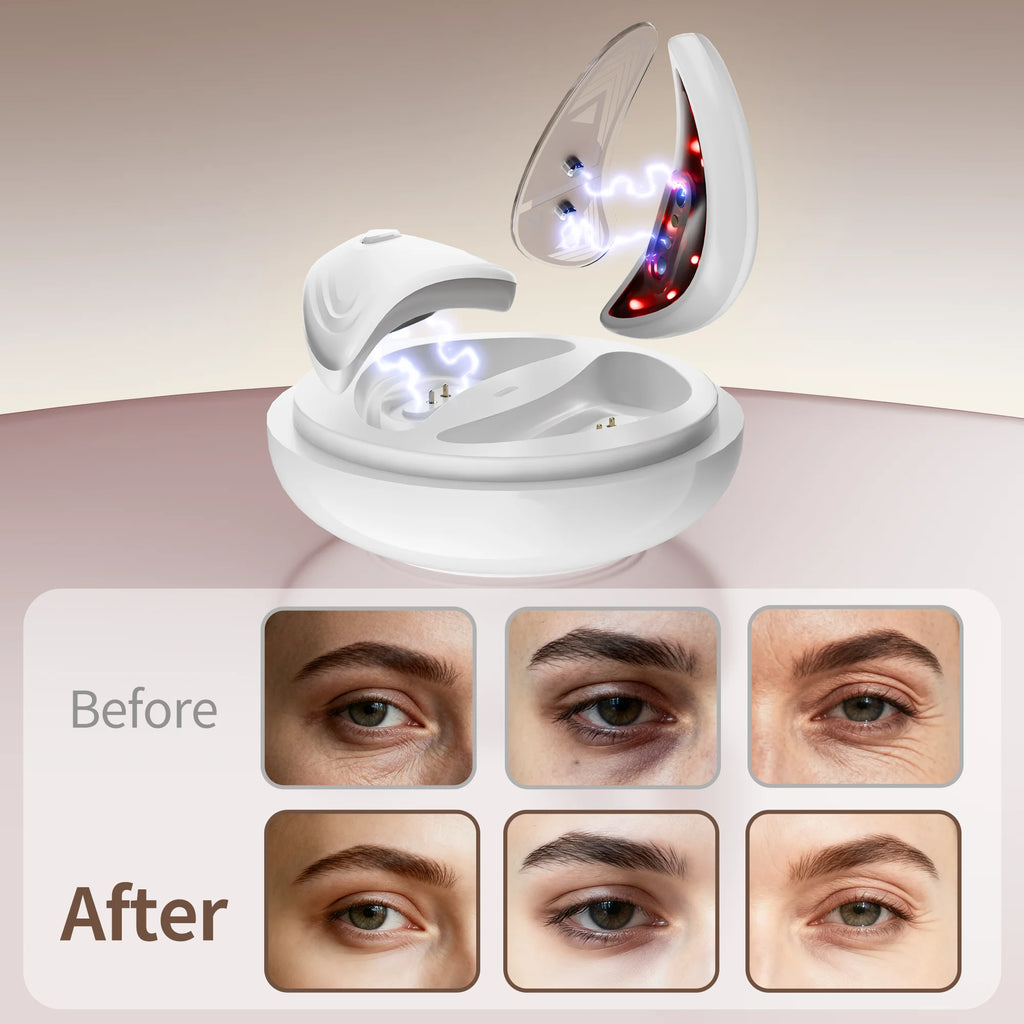 Red Light Microcurrent Under Eye Massager for Dark Circles