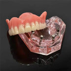 Cosmetic Silicone Teeth Covers for Instant Smile Confidence
