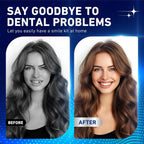 Comfort Fit Instant Smile Veneers Upper and Lower Set