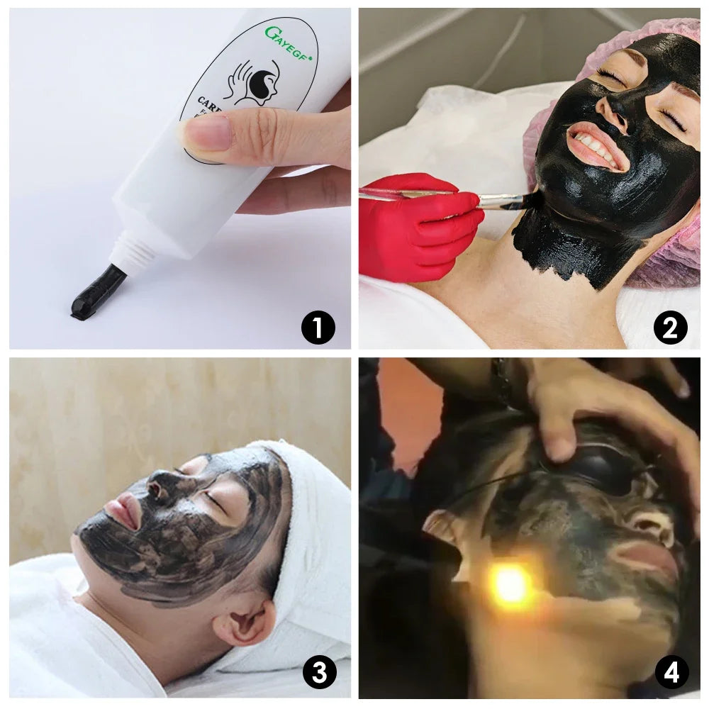 Carbon Laser Gel for Facial Deep Cleansing and Skin Rejuvenation