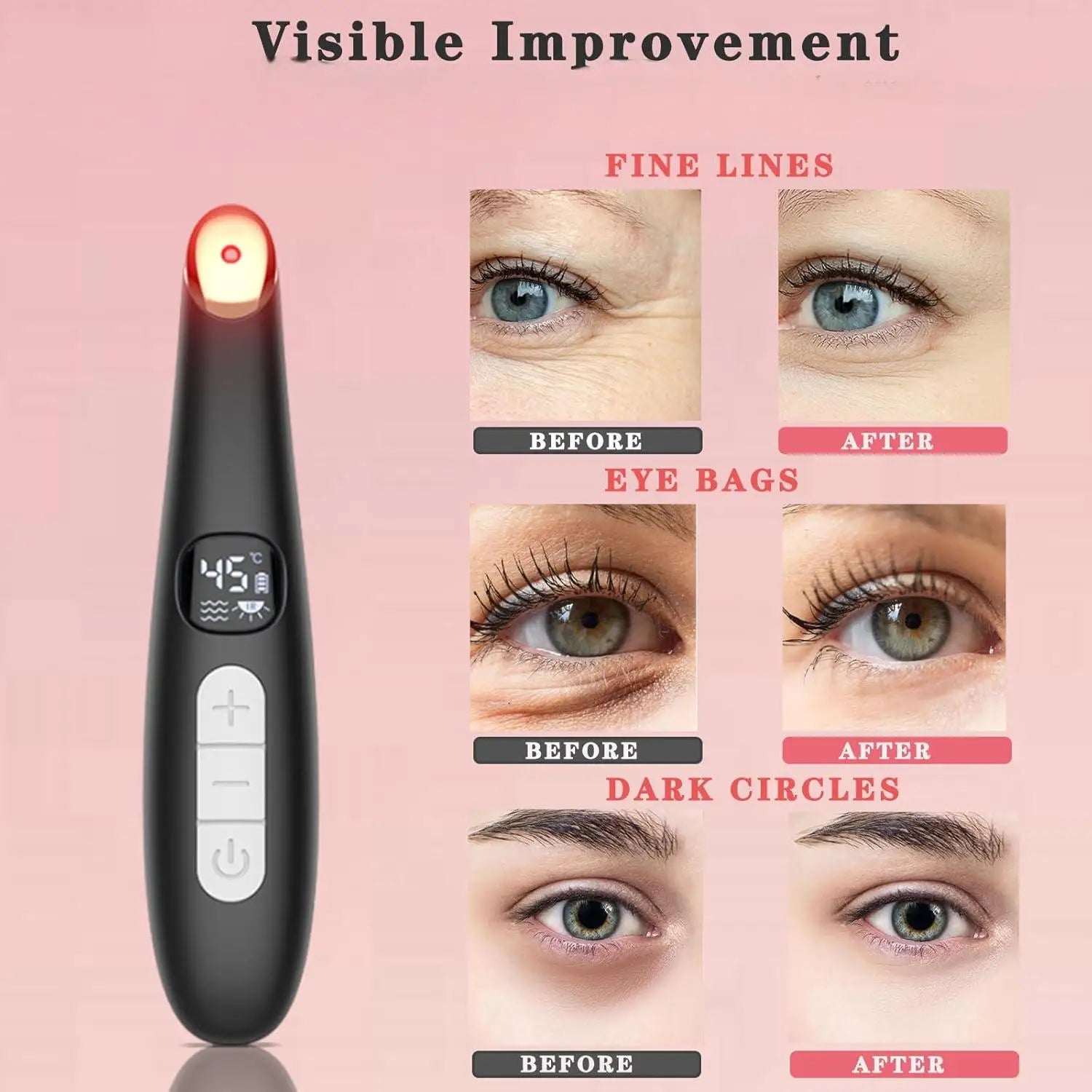 3-in-1 Heated Eye Massager Wand for Dark Circles and Puffiness - 2
