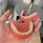 Custom Silicone Upper and Lower Denture Set for Natural Smile