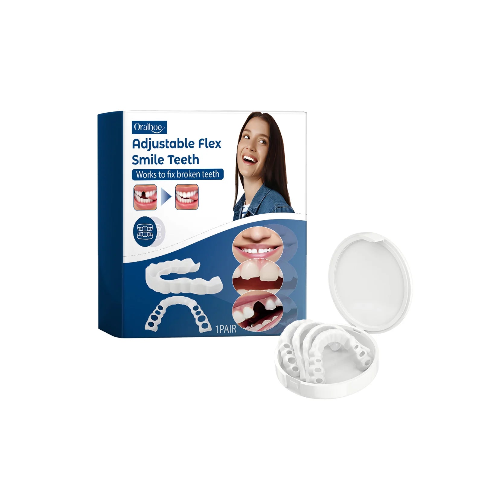 Adjustable Snap-On Smile Veneers for Missing Teeth - 22