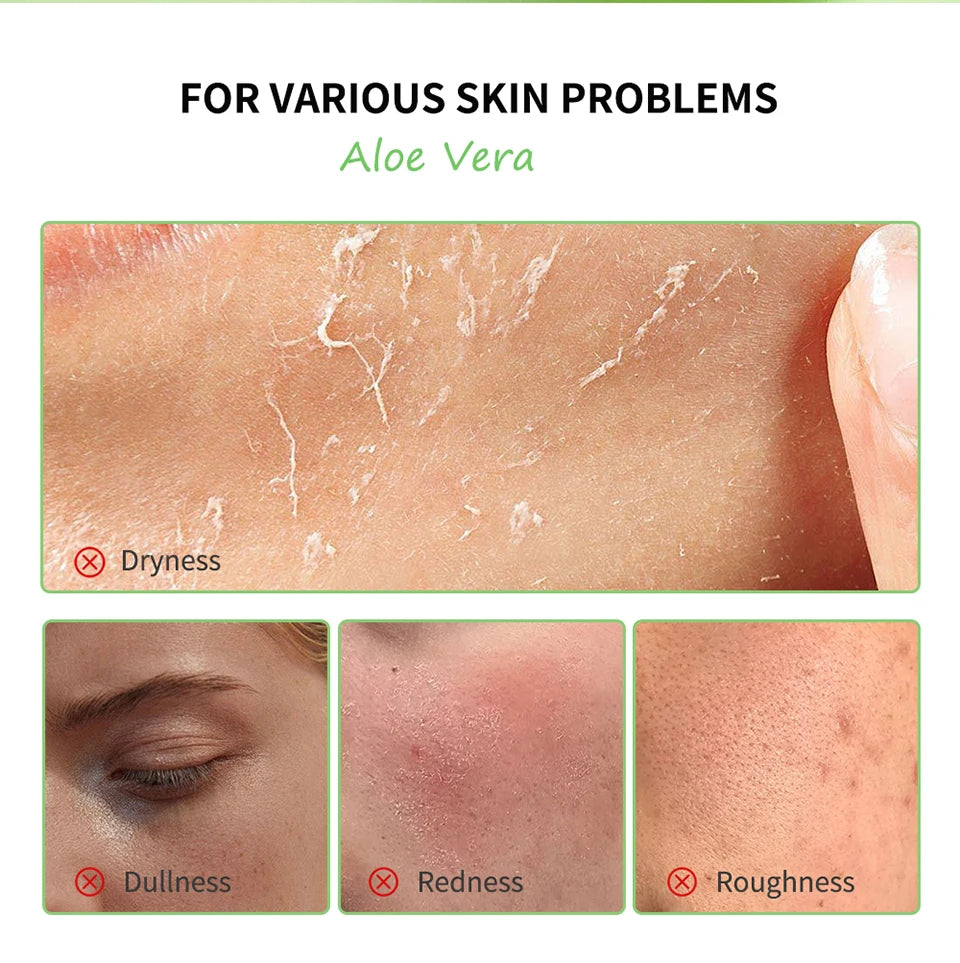 Soothing Aloe Vera Moisturizing Gel for Face and Skin - 8