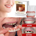Custom Fit Cosmetic Denture and Reline Set for a Confident Smile
