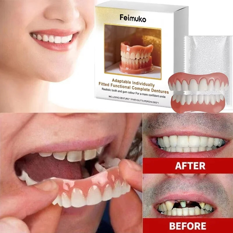 Custom Fit Cosmetic Denture and Reline Set for a Confident Smile