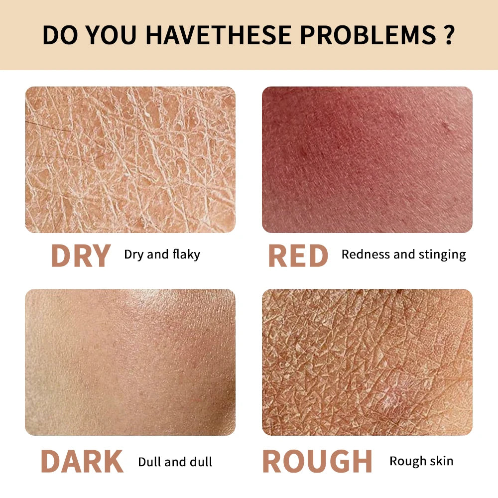 Deeply Hydrating Hydrogel Facial Cream for Nourished Skin - 6