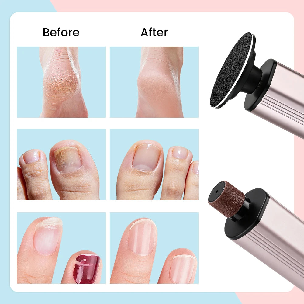 Electric Callus Remover and Pedicure Foot File Tool - 11