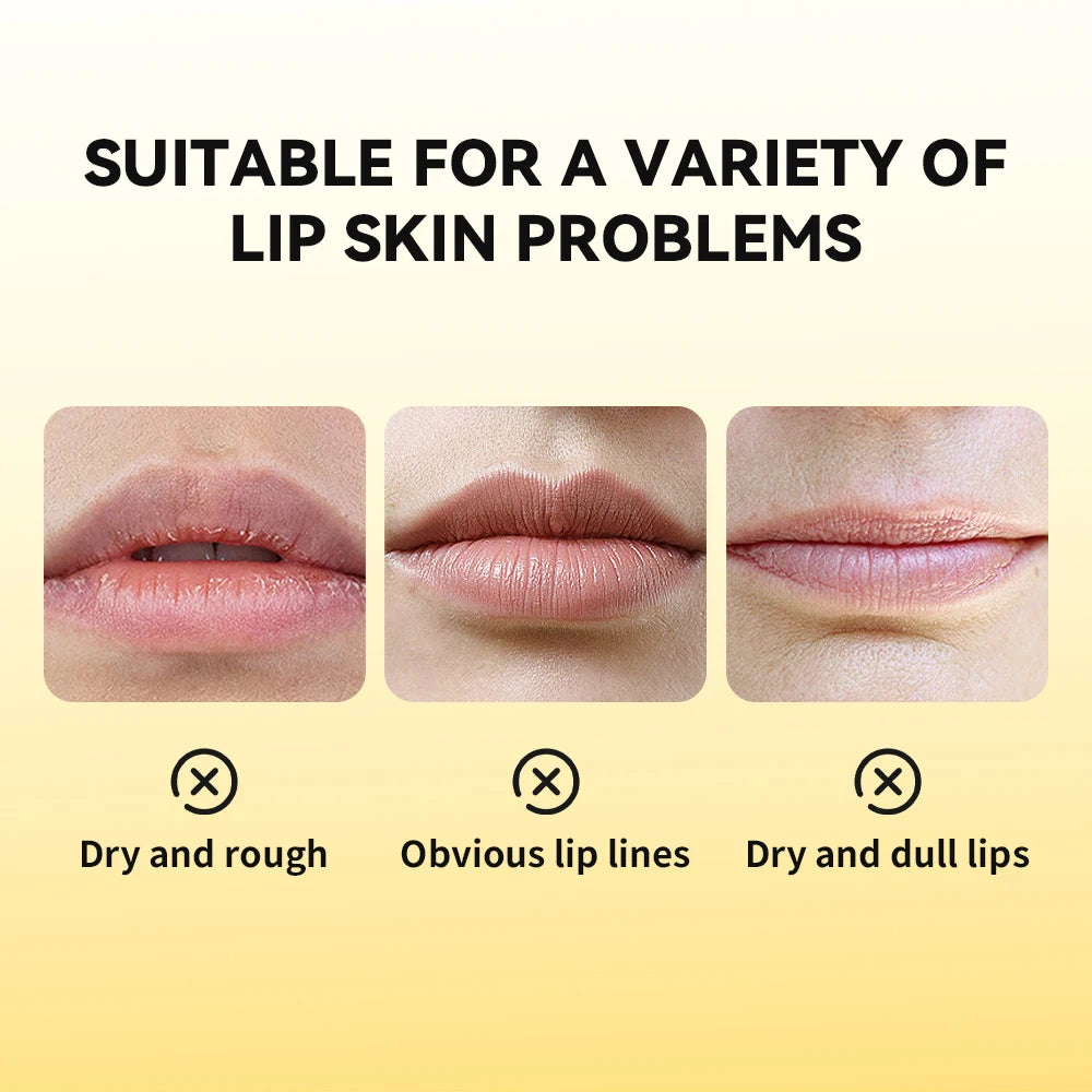 Propolis Hydrating Overnight Lip Repair Gel - 5