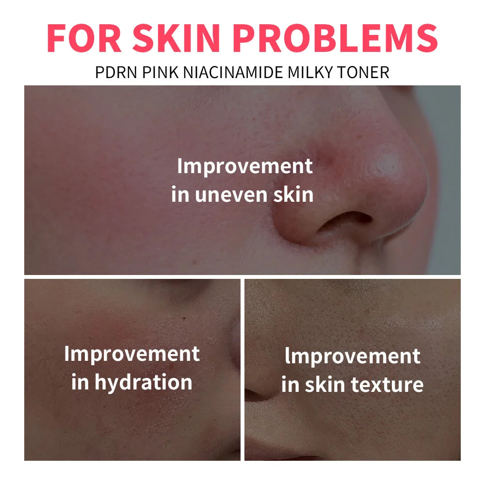 PDRN Niacinamide Milky Facial Toner for Hydrating Glowing Skin