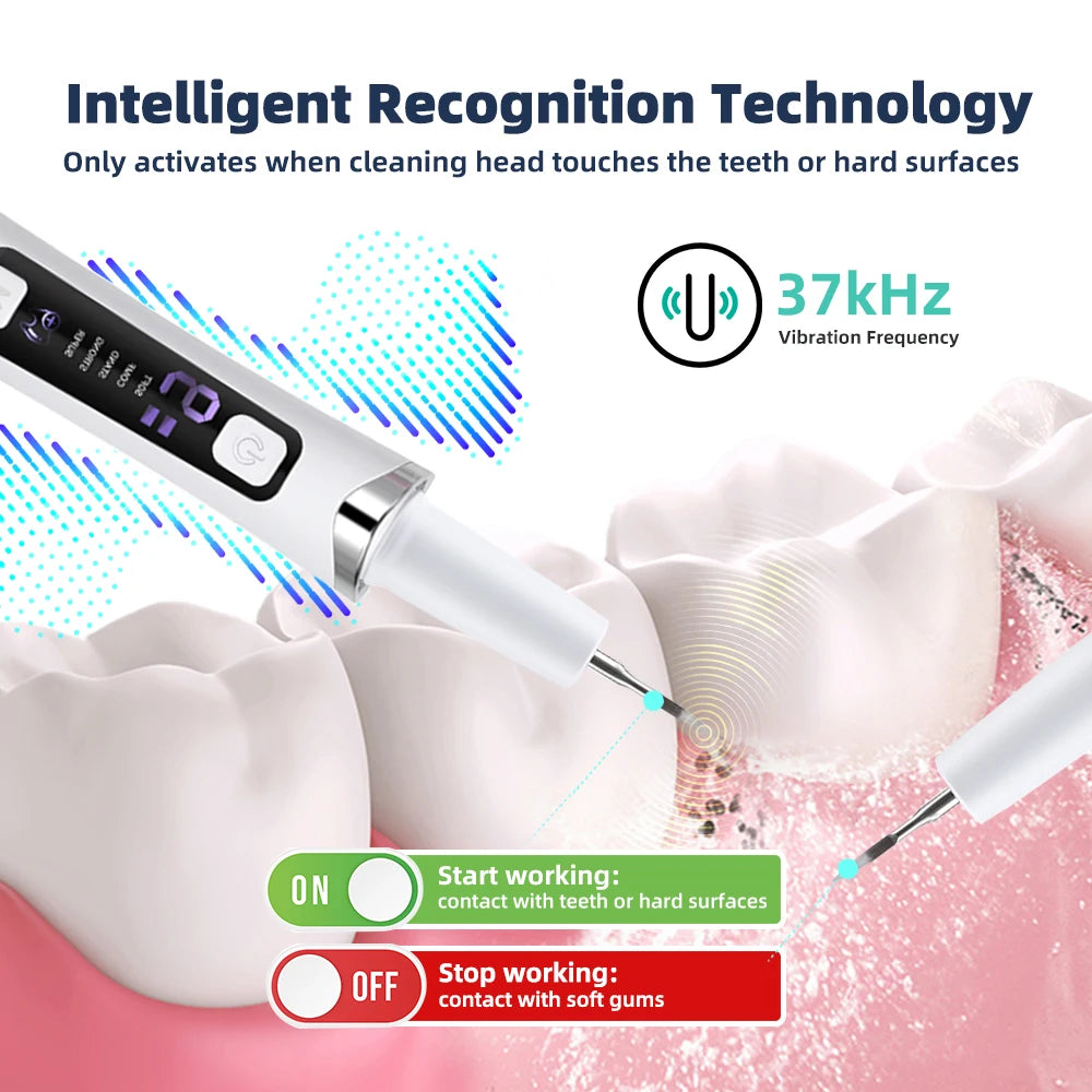Ultrasonic Electric Teeth Tartar and Plaque Remover - 12