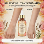 Cyperus Oil Natural Hair Growth Inhibitor and Skin Soothing Serum