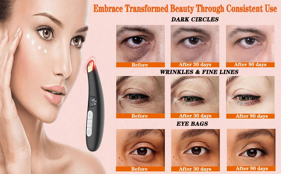 3-in-1 Heated Eye Massager Wand for Dark Circles and Puffiness