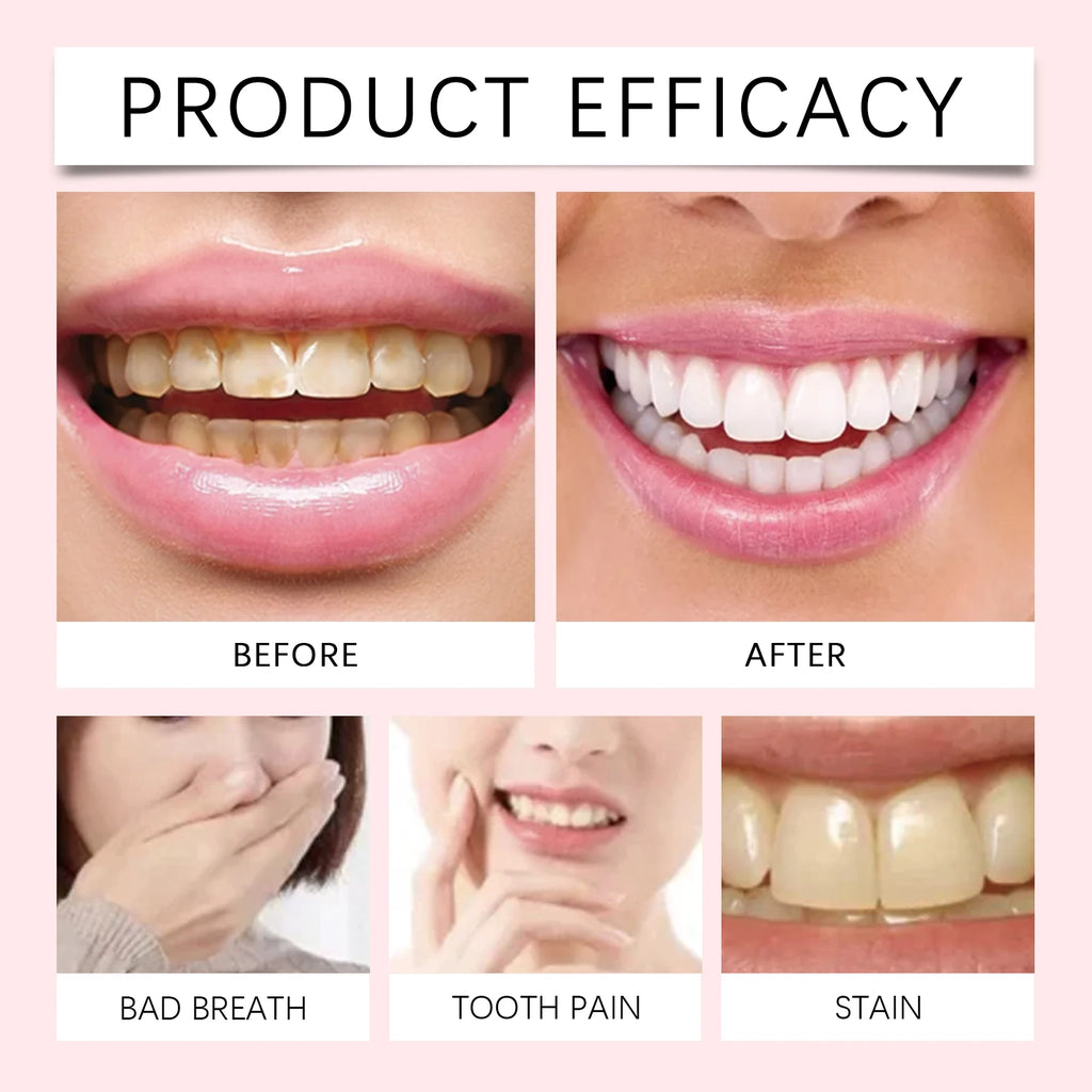 Brightening and Cavity Repair Teeth Whitening Toothpaste