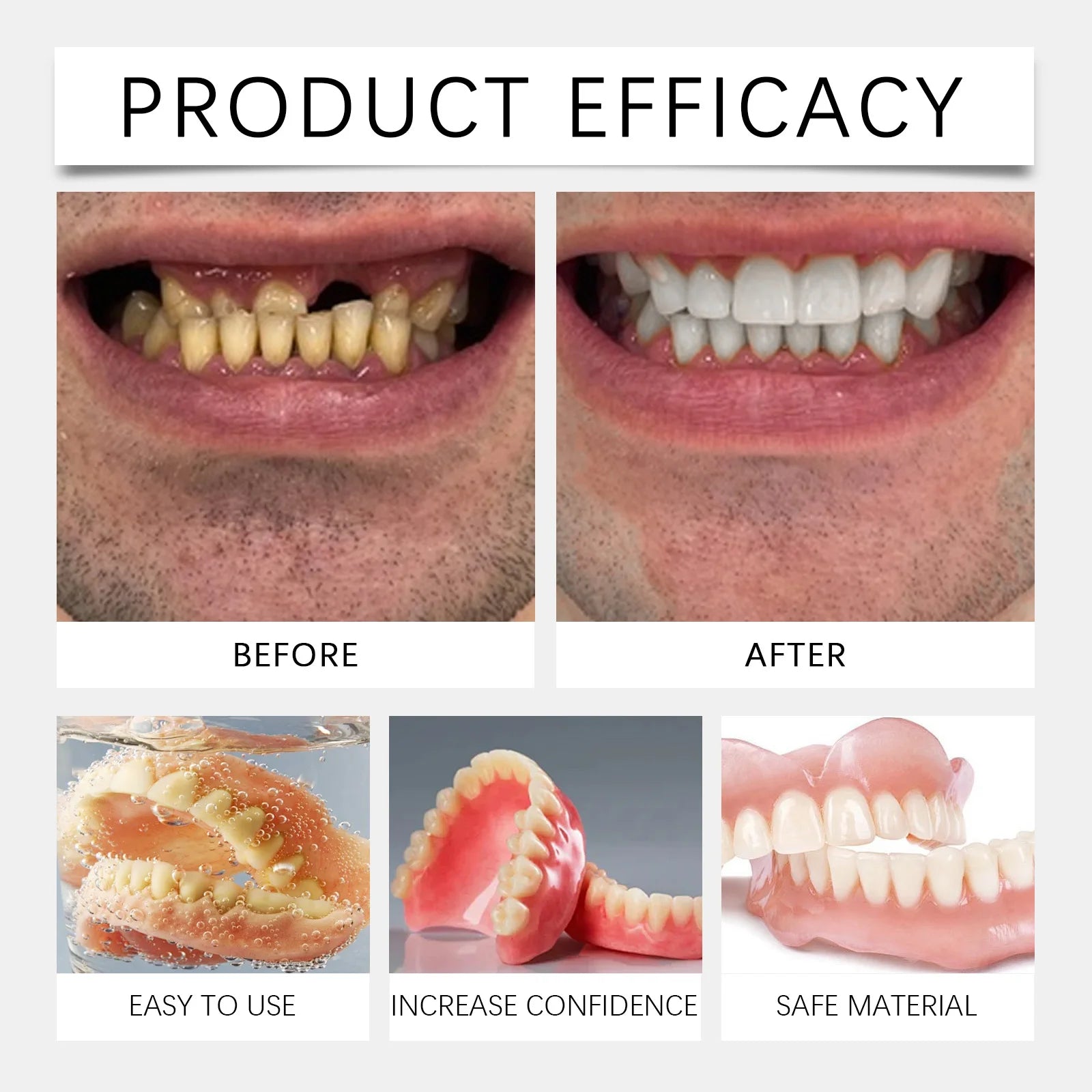 Temporary Silicone Denture Kit for Smile Restoration - 5
