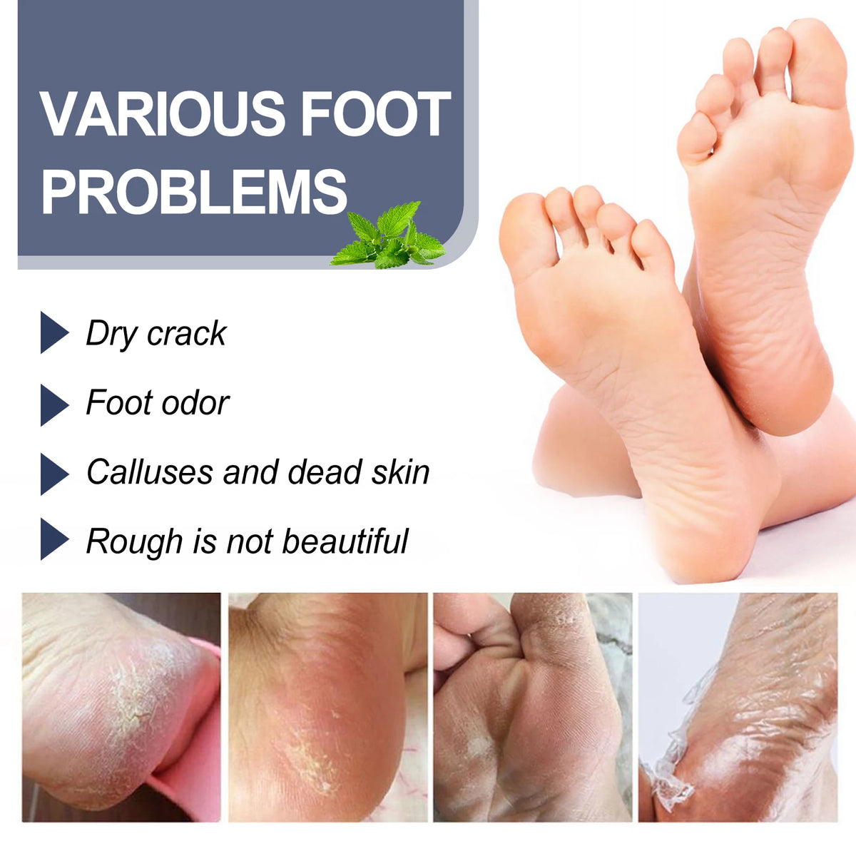 Refreshing Deodorizing Foot Spray for Odor Removal and Dry Skin