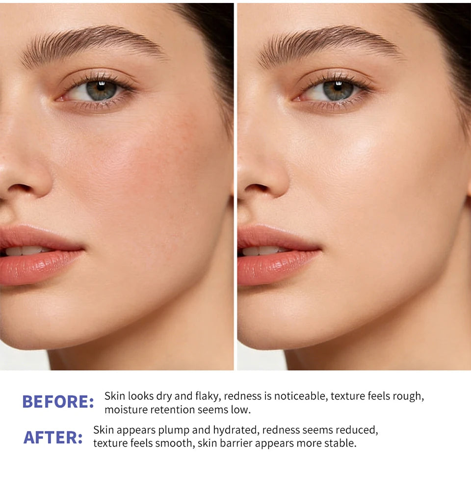 Triple Lipid Peptide Moisturizing Cream for Dry and Sensitive Skin