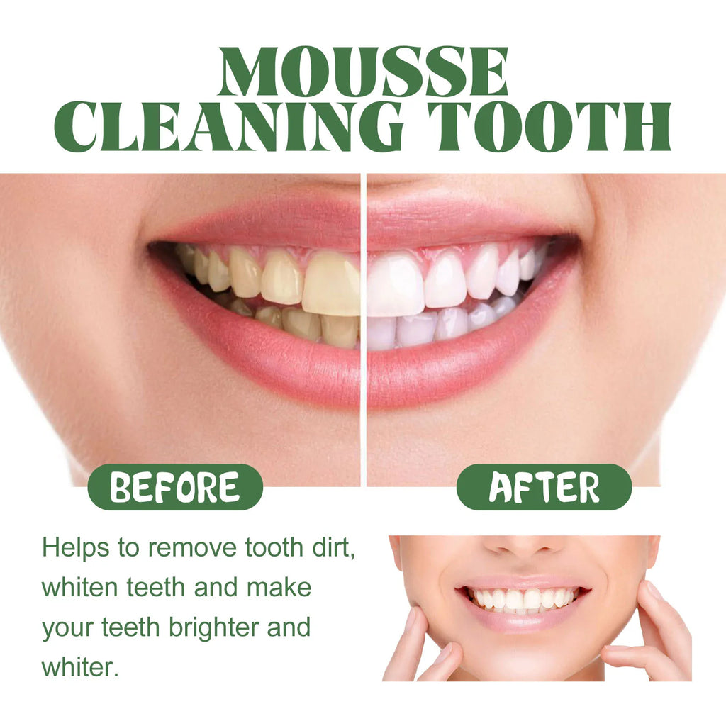 Whitening Foaming Toothpaste for Stain Removal