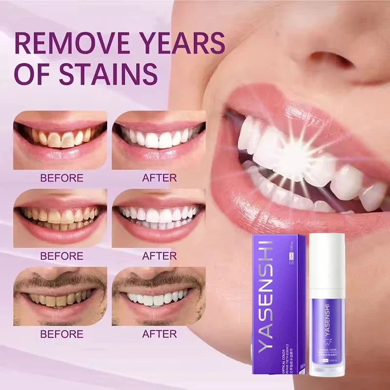 Deep Cleaning Teeth Whitening Foam Toothpaste - 2
